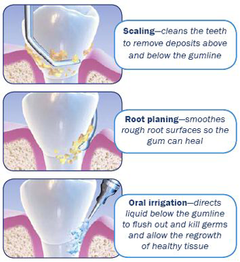 Botox® in New York, NY