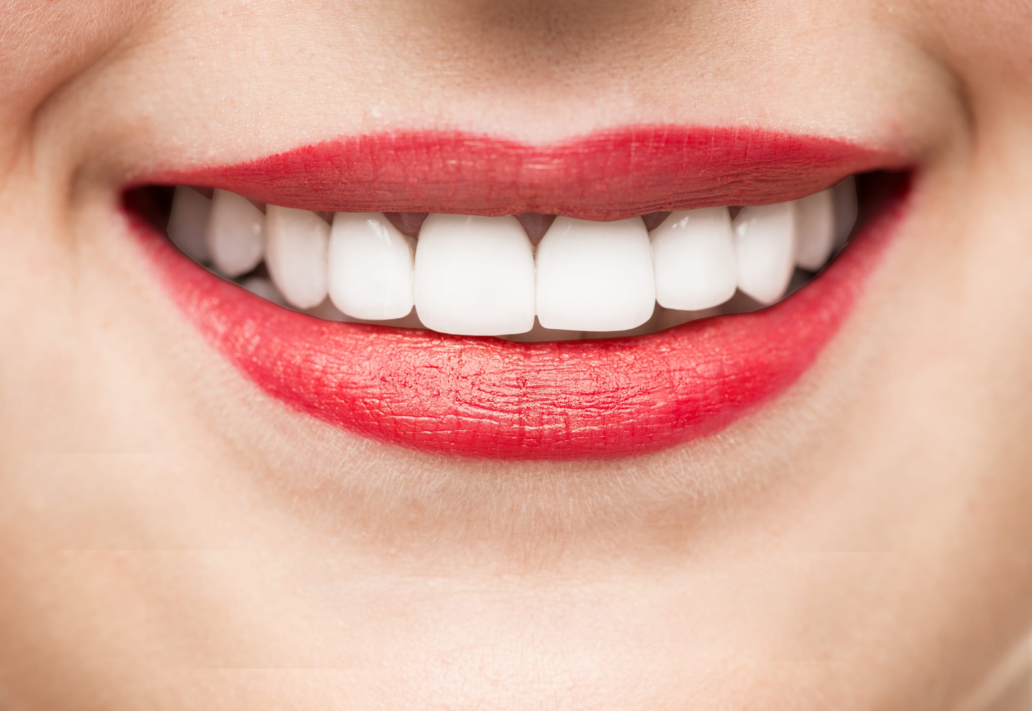 Is Smile Direct Club a good choice for your Orthodontic Treatment?