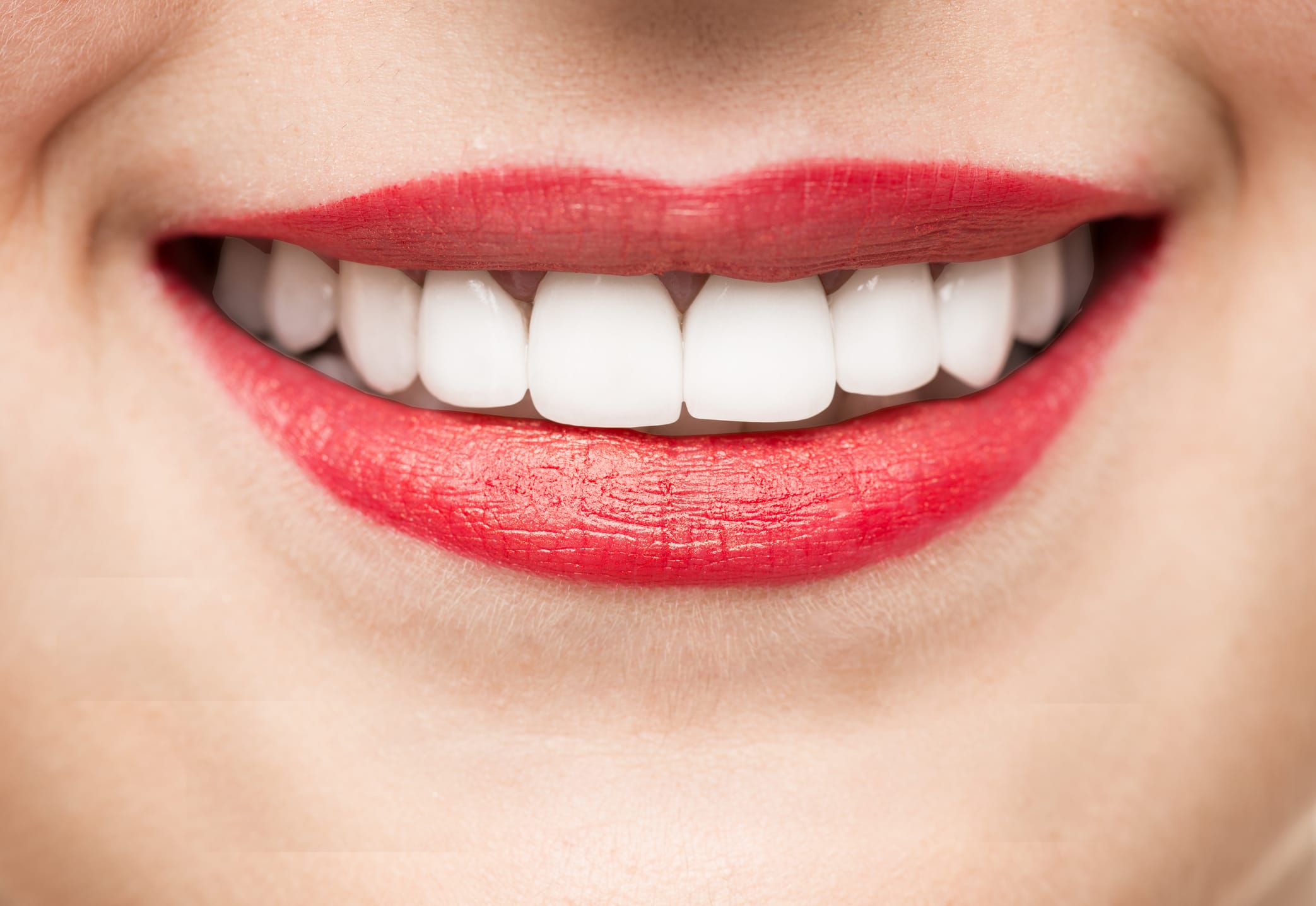 Is Smile Direct Club a good choice for your Orthodontic Treatment? -  Carlyle Dental