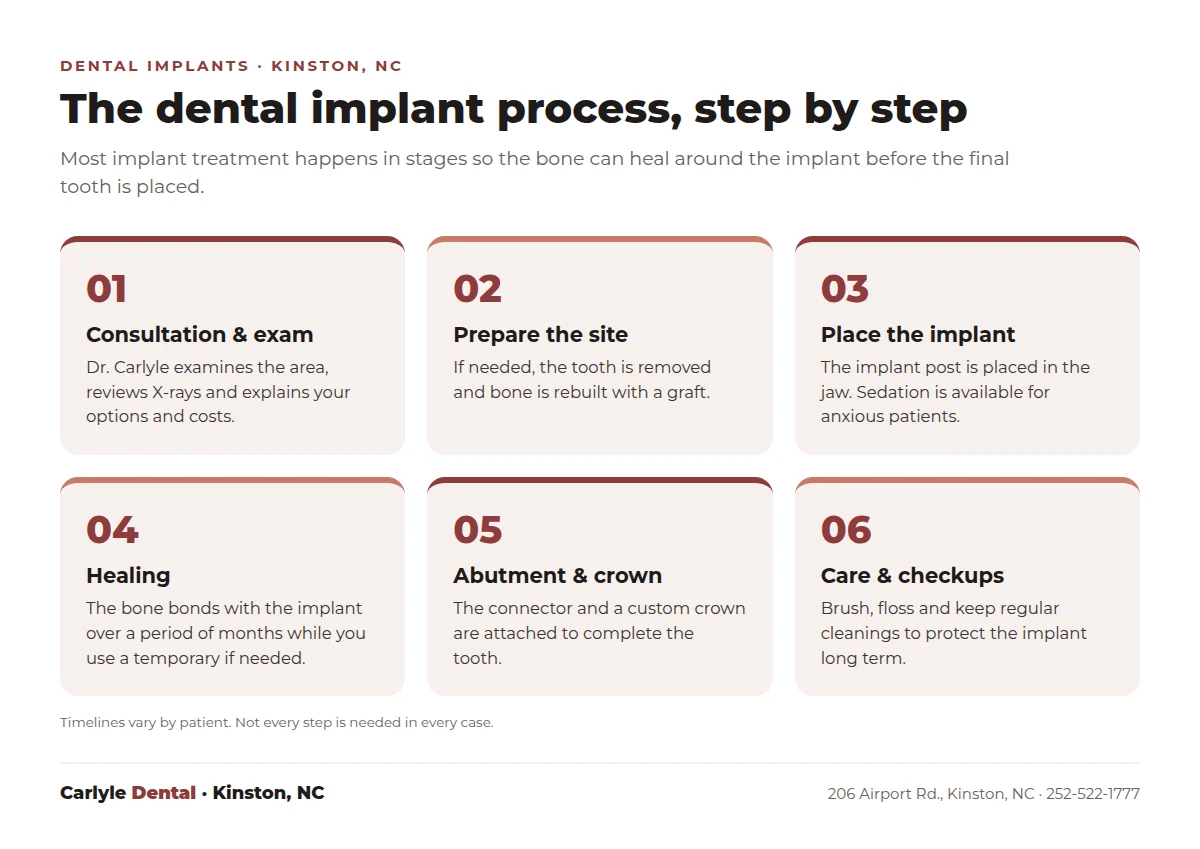 Six-step dental implant process at Carlyle Dental in Kinston NC: consultation and exam, preparing the site, placing the implant, healing, abutment and crown, care and checkups