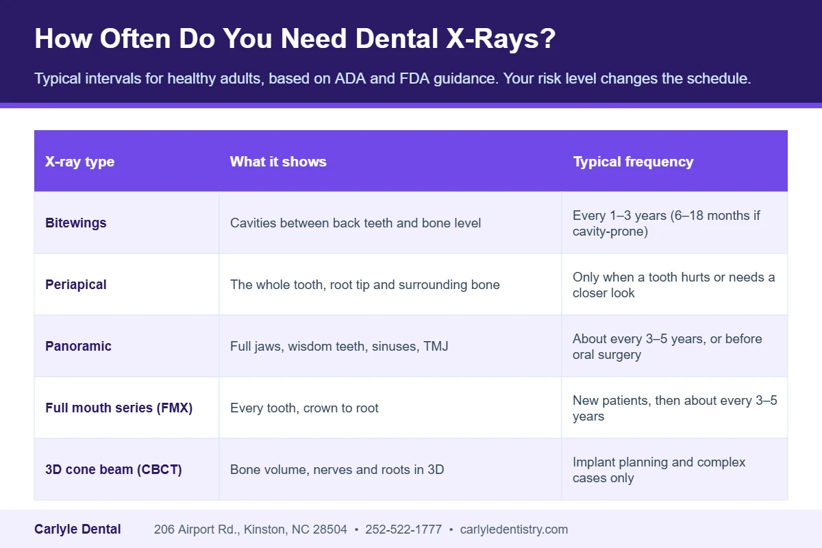 Chart of how often dental x-rays are taken: bitewings, periapical, panoramic, full mouth series and 3D cone beam